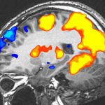 fMRI scan